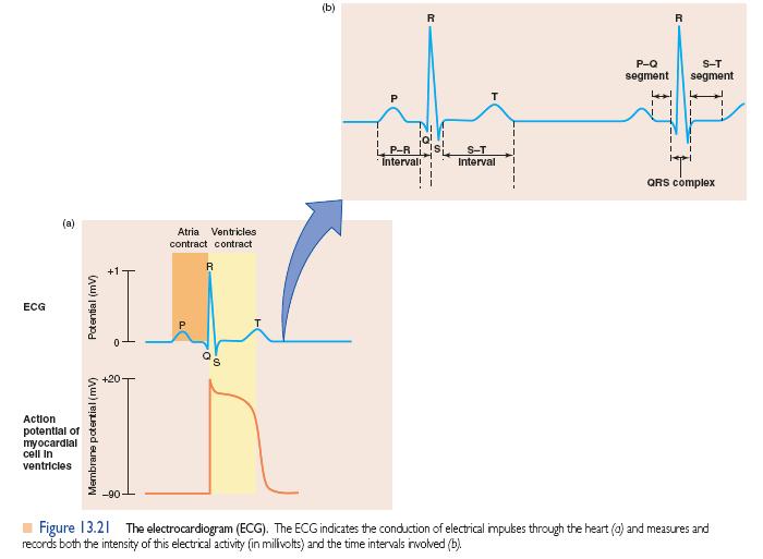 ECG e