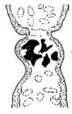 Figura 7. (esq. => dir.) Xiphinema machoni: detalhe do órgão-z no sistema reprodutor feminino; variações na cauda da espécie (3x); e X. diffusum: cauda típica (2x). Figura 8. (esq. => dir.) Xiphinema sp: detalhe do odontoestilete; X.
