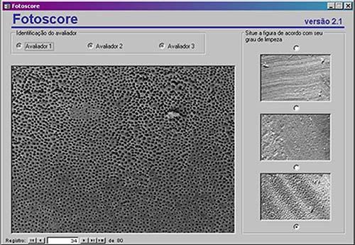 Material e método Desenvolvimento do software Fotoscore No intuito de automatizar o processo de avaliação das fotomicrografias e registro dos resultados de acordo com os diferentes examinadores, foi