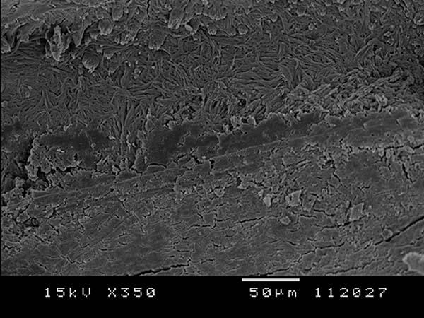 Resultados Figura 12 - Fotomicrografia eletrônica de varredura da porção apical