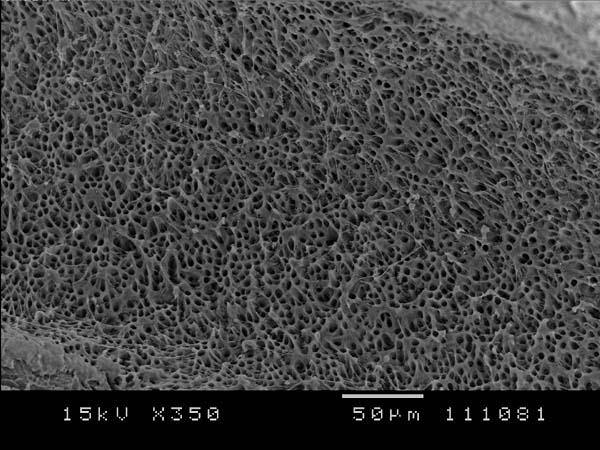 13 - Fotomicrografia eletrônica de varredura da porção apical do canal radicular