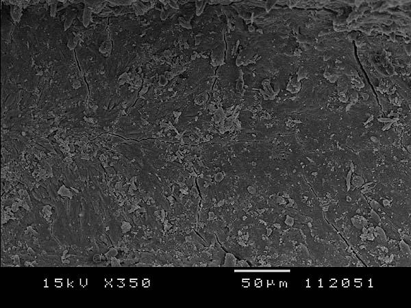 Resultados Figura 14 - Fotomicrografia eletrônica de varredura da porção apical do canal radicular após a