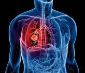 Nova Norma: ISO 16890 Com o objetivo de melhorar os padrões de qualidade do ar, a norma ISO 16890 está alinhada com o critério da OMS, dividindo as faixas de partículas em PM10, PM2,5 e PM1,