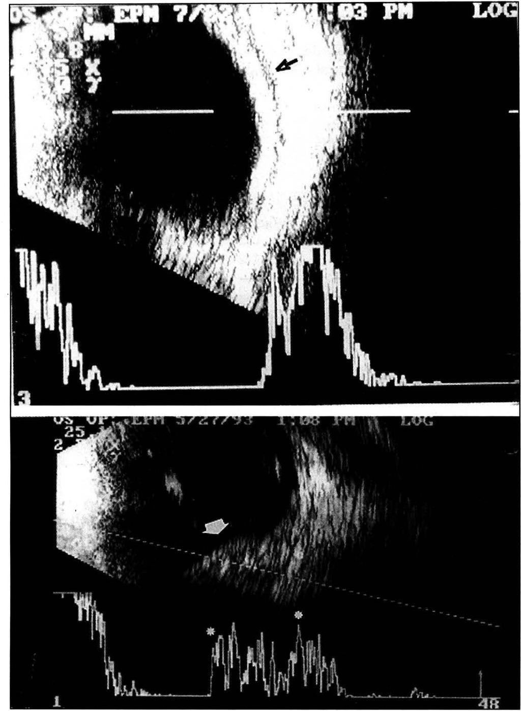 Fig. 2. A.