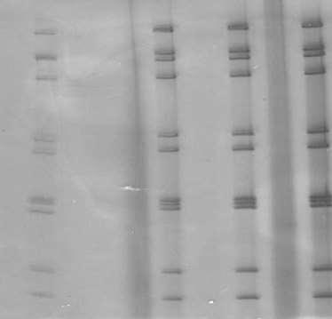 Rotavírus: Diagnóstico laboratorial Detecção do genoma viral: Eletroforese em gel de poliacrilamida (EGPA) diferencia RV-A de outros grupos A B C D E F G H Eletroforese em gel de poliacrilamida de