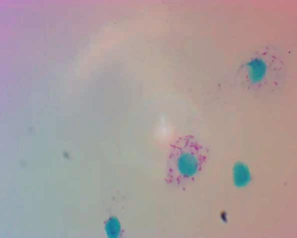 112 Carrapatos na cadeia produtiva de bovinos Figura 1. Rickettsia parkeri parasitando hemócito do carrapato Amblyomma ovale (Coloração de Gimenez).