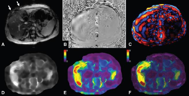 Venkatesh et al, J