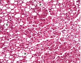 Avaliação da esteatose: Proporção de hepatócitos que contém macrovesículas de gordura
