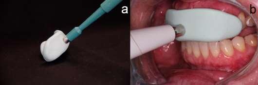 confecção de uma matriz nos dentes anteriores superiores.