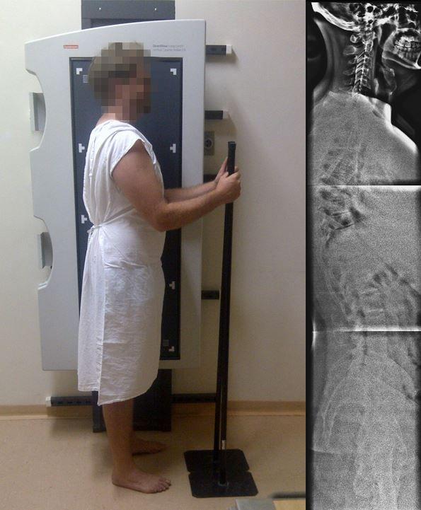 53 Figura 21: Posicionamento para aquisição da radiografia panorâmica no plano sagital. À direita está a radiografia digital do mesmo paciente. Fonte: Acervo pessoal.
