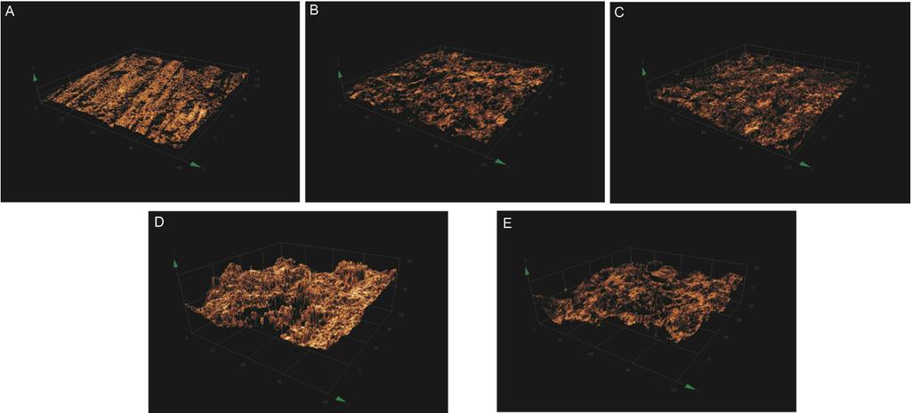 Resultados 107 Figura 22. Imagens representativas da topografia de superfície dos discos em MCVL.