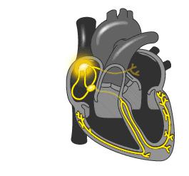 ATIVIDADE ELÉTRICA DO CORAÇÃO Inclui todos os processos envolvidos na ativação elétrica para contração do coração O estímulo para contração do músculo cardíaco é gerado pelas células marcapasso,