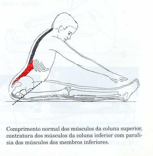 Comprimento normal extensores do tronco