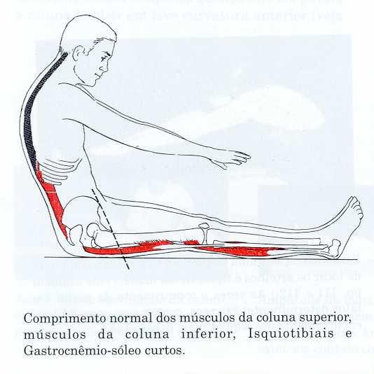 excessivo extensores torácico com