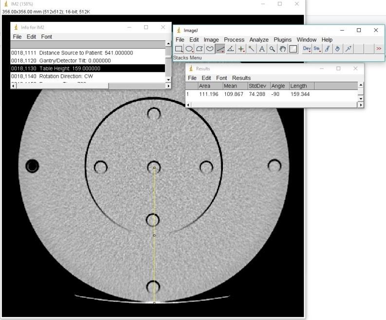 1. Introdução A tomografia computadorizada (CT) é uma técnica de obtenção de imagens reconhecida como essencial ao diagnóstico de várias patologias.