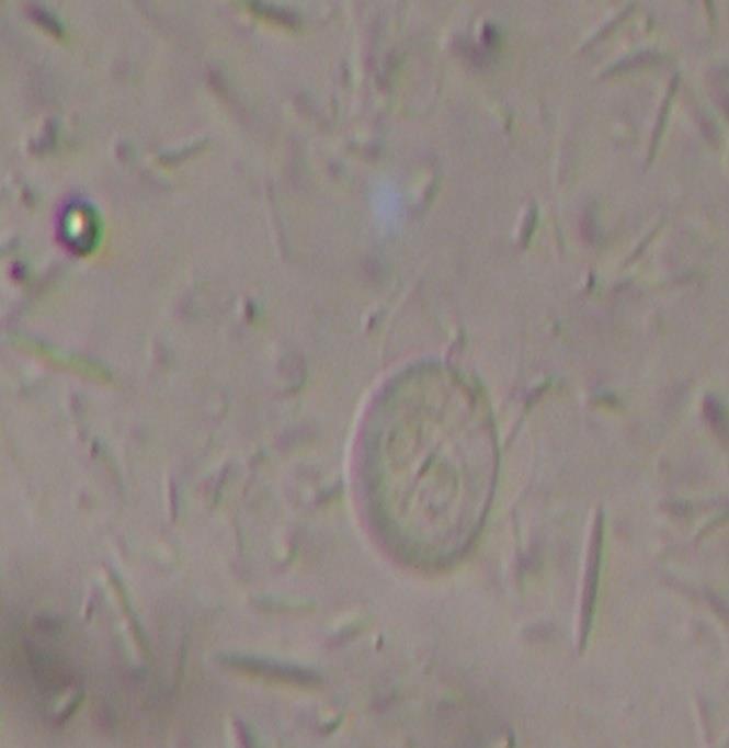 46 A infecção por G.muris ocorre através da ingestão do cisto, que é a forma infectante. Estes cistos elipsoides que medem 15 a 17 µm aparecem nas fezes dentro de 3 a 5 dias, após a ingestão.