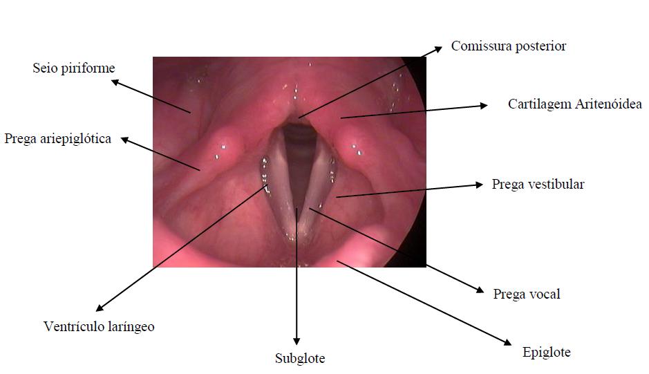 9 Figura 2 Anatomia da laringe Fonte: Autoria própria Os pacientes com Doença do Refluxo Laringofaríngeo (DRLF) apresentam menos sintomas típicos que os pacientes com DRGE clássica 8.