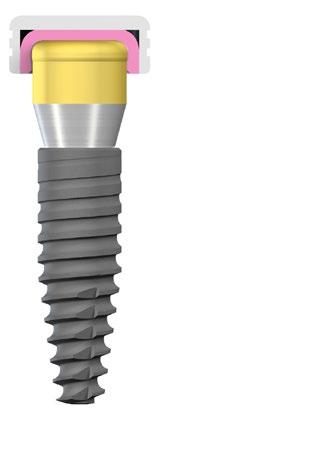 Linha de implante Conexão Alturas do pilar Standard Plus Bone Level Tapered Bone Level Tapered NNC RC NC 1 mm 2 mm 3 mm 4 mm 5 mm 6 mm 2 mm 3 mm 4 mm 5 mm 6 mm Altura
