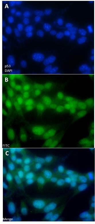 100 Figura 22 Análise da expressão de p53 no citoplasma das células-tronco fetais de membrana amniótica 35d Legenda: Neste experimento as células-tronco da membrana amniótica de fetos caninos 35d.