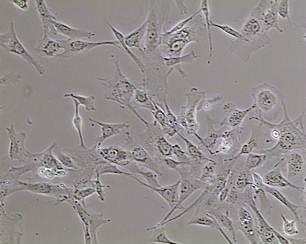 Nas primeiras passagens celulares foi possível observar uma população mista de células, com morfologias de células epiteliais e de