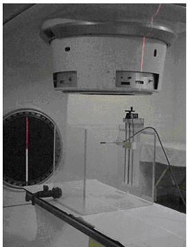 humano [17]. O simulador antropomórfico reproduz a anatomia humana com as propriedades da interação da radiação.