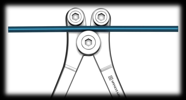 .1.009) quando necessário, para tomar a forma mais próxima do ideal, ao contorno da espinha desejado, lordótico na coluna lombar e cifótico na coluna torácica.