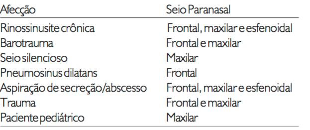 Tabela 2 : Indicações para o uso da Sinuplastia Fonte: Júnior JFN, Silva MLS, Santos FP, Stamm AC. Sinuplastia com Balão: Um Novo Conceito na Cirurgia Endoscópica Nasal.