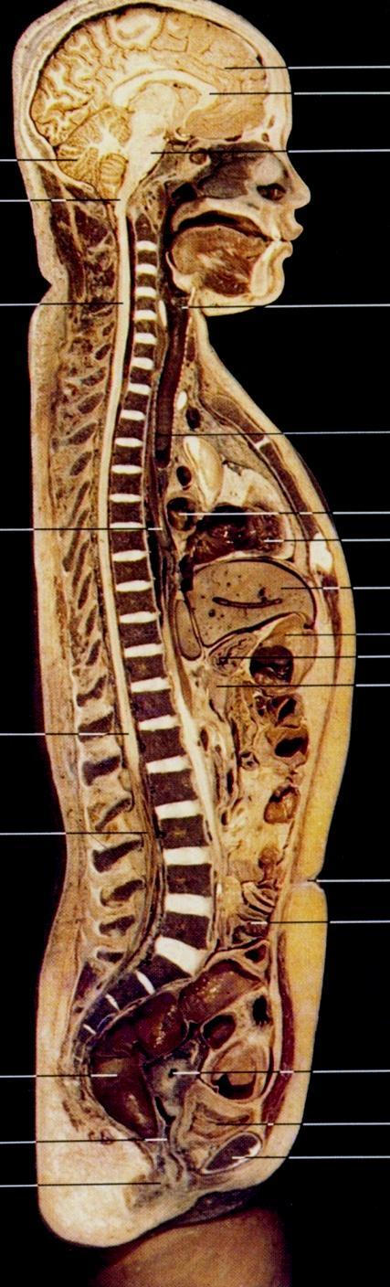 Divisões do Sistema Nervoso Critério anatômico cérebro Sistema Nervoso Central Encéfalo cerebelo tronco encefálico mesencéfalo ponte