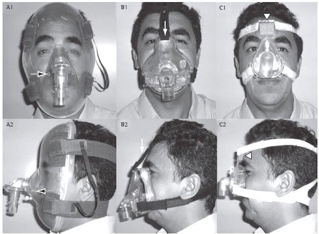 c) O tipo de interface e o modo ventilatório Os fatores mais importantes para o sucesso da VMNI são a seleção criteriosa dos doentes, o início atempado da terapêutica, o tipo de abordagem ao doente,