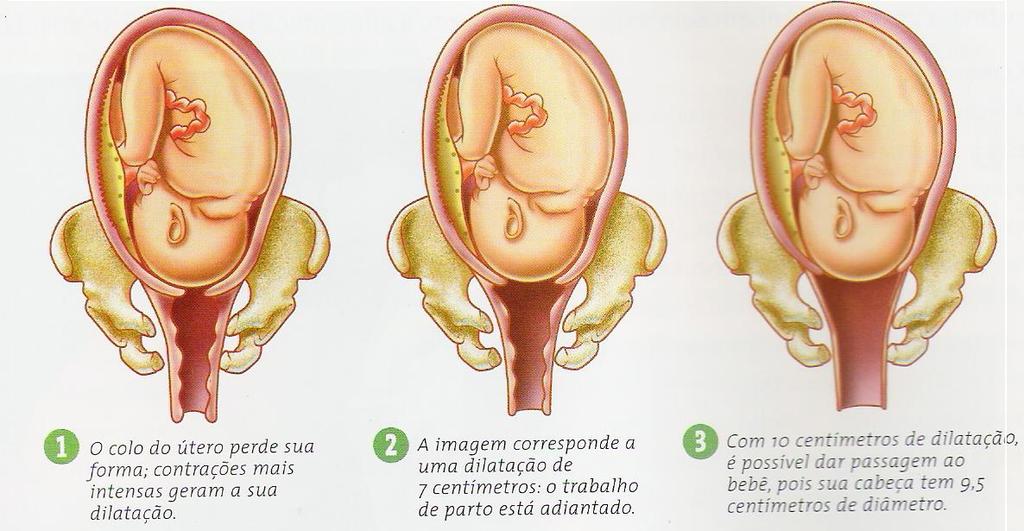 Dilatação