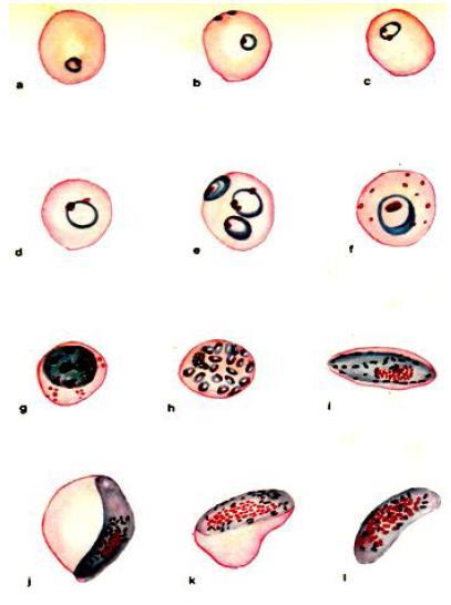 Figura 2.5: Formas sanguíneas de P. falciparum, P. vivax e P.