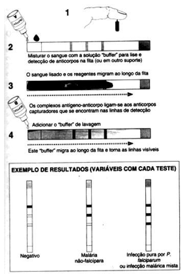 Figura 2.6: Diagnóstico imunológico da malária através de teste imunocromatográfico. Fonte: (Rey, 2008).
