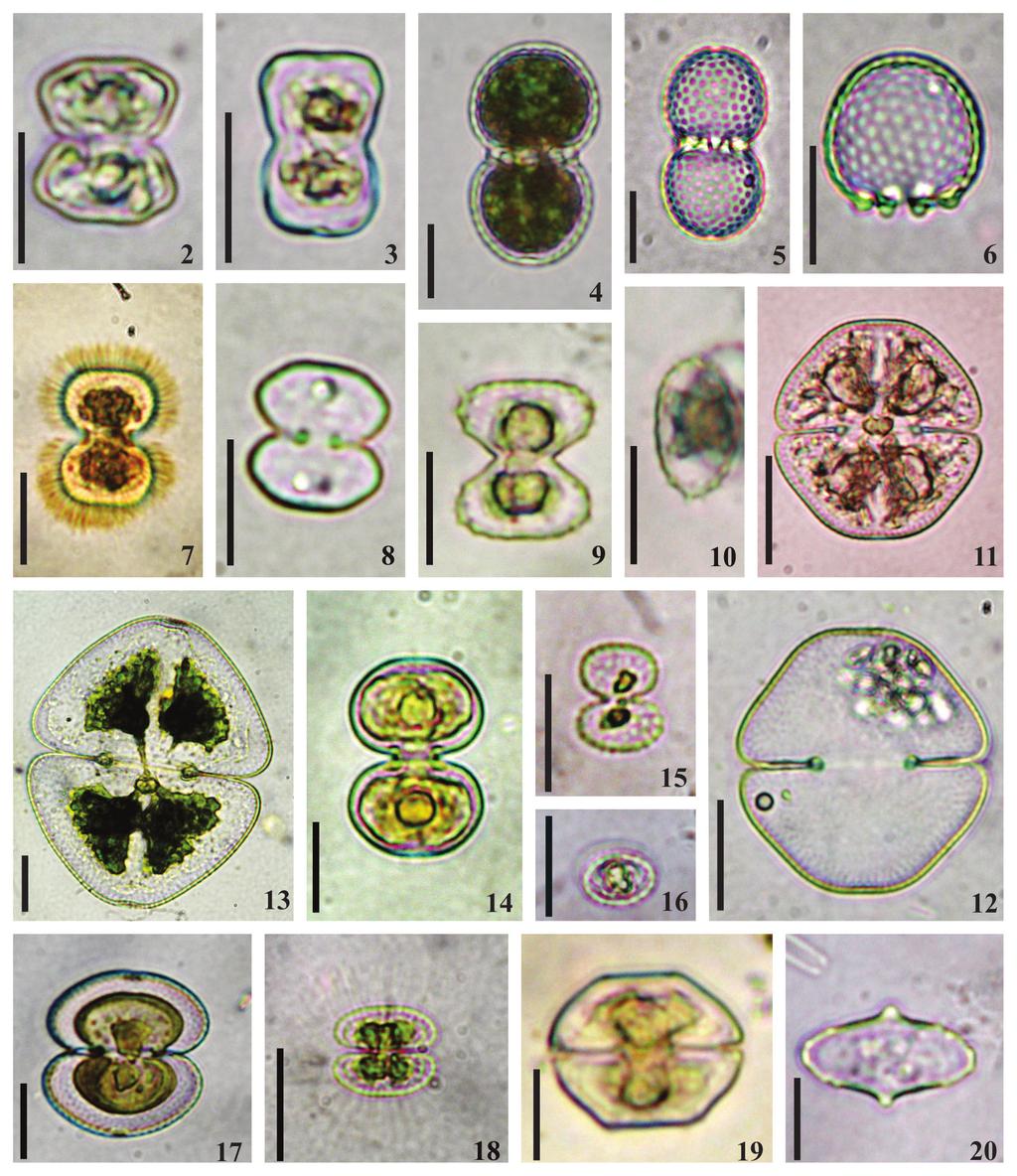 222 Hoehnea 43(2): 217-236, 2016 Figuras 2-20. 2. Cosmarium achondroides var. minus. 3. C. arctoum var. arctoum f. arctoum. 4-6. C. basituberculatum. 5. Detalhe da parede. 6.