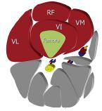 18 Figura 2. Anatomia do quadríceps. Plano axial: VL = vasto lateral, VI= vasto intermédio, VM = vasto medial e RF = reto femoral. Fonte: Pasta, G.