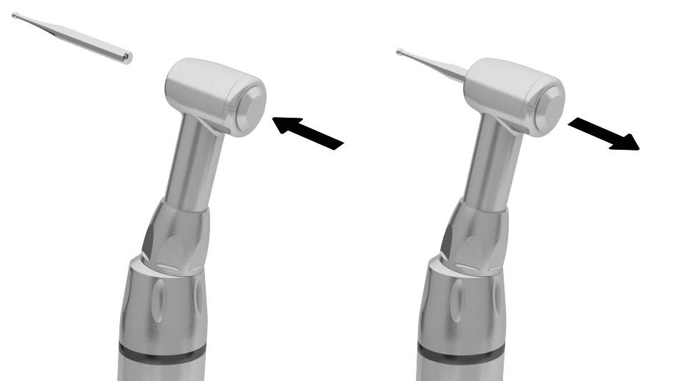 16 5.4 FIXAÇÃO DA BROCA SISTEMA PUSH BUTTON - MODELO: T20 1. Encaixar a broca na pinça (Fig. 09). 2. Pressionar a tampa da cabeça (Fig. 09). A pinça interna irá abrir permitindo a passagem do eixo da broca.