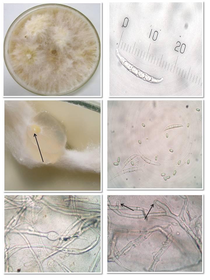 49 A B C D E F Figura 3 - Características morfológicas de Fusarium sambucinum.