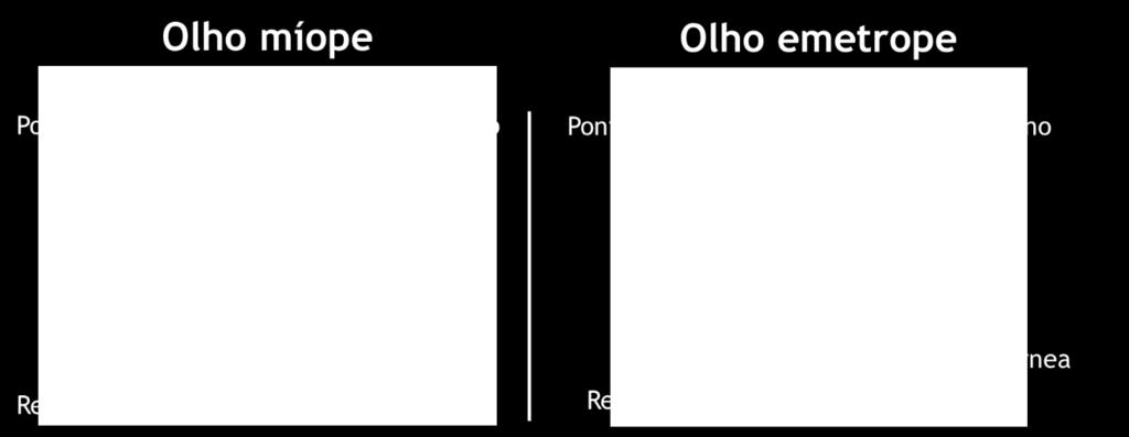 Localização do ponto focal num olho míope e num olho emétrope. (Adaptado (16)).