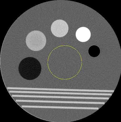 σ 1 = N i=1 (HU1 HU)² N 1 (1) Neste estudo, para avaliação do ruído, as imagens foram avaliadas por meio do software ImageJ.