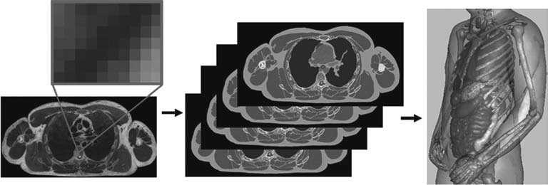 45 da anatomia humana. A cada voxel é atibuído um númeo identificado que possibilita difeencia os ógãos e tecidos (KRAMER e et al., 003).