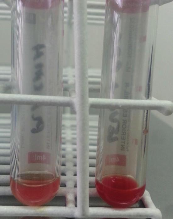 FIGURA 3 (A) Frascos contendo PRP e leucócitos à direita e plasma à esquerda após serem coletados e separados na centrifugação do sangue total colhido com EDTA de um cão.