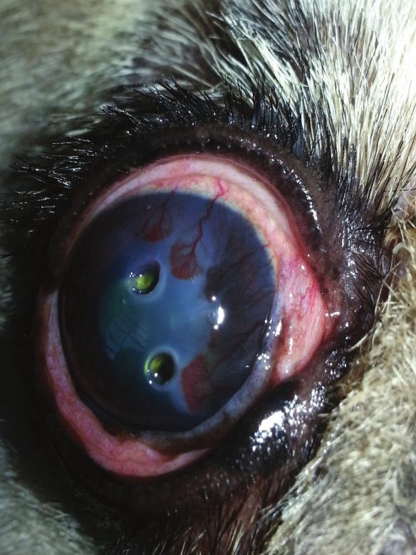 ocular ou remoção do enxerto. Foram mantidos os colírios durante o pós-operatório, moxifloxacino (Vigamox ) QID e lubrificante (Oftane ) TID, após limpeza com gaze umedecida em NaCl 0,9% estéril.