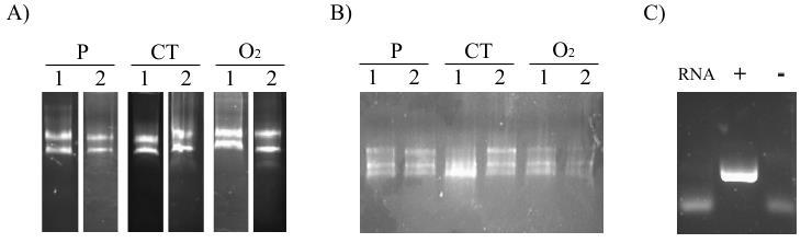 18 não houve amplificação nas reações utilizando RNA, indicando a ausência de DNA na amostra (Figura 3C). C CT C CT Figura 3. Qualidade do RNA e tratamento com DNase I.