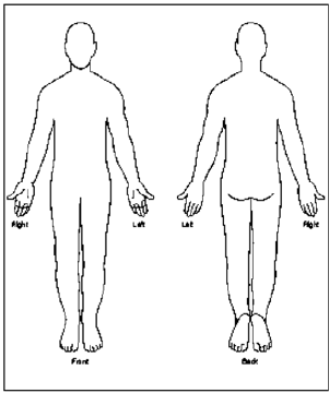 Anexo 1 Ao utilizar o diagrama do corpo (em crianças, um equivalente aproximado da Escala de Cores de Eland), é pedido aos doentes que indiquem, com um marcador, a localização da sua dor (que pode