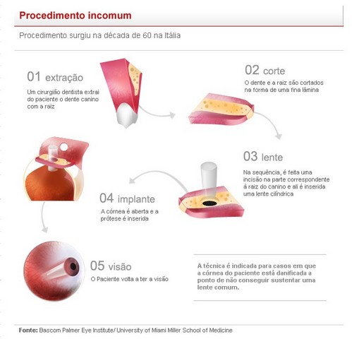 Ferramenta para Análise de Multimidialidade em Cibermeios 101 Exemplo 29. G1 Infografia de primeira geração http://g1.