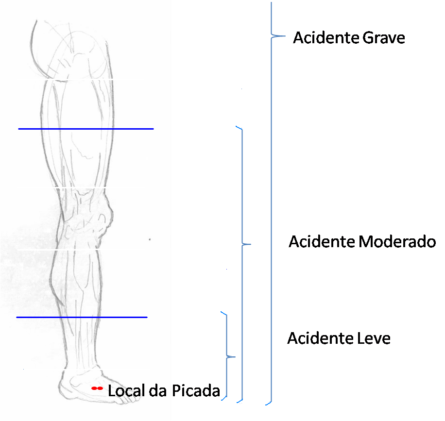 1.2 Acidente botrópico O acidente botrópico é causado pela serpente do gênero bothrops, conhecidas popularmente como jararaca, jararacuçu, preguiçosa, dentre outros nomes.