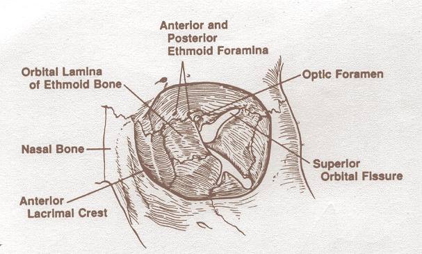 14 26% de rarefação óssea e 14% de deiscência. Tromboflebites dos vasos sinusais podem levar infecção para a órbita. Extensão direta pode ocorrer através dos espaços perivasculares. fig.