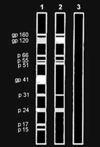 Figura 18: Um desenho de resultados de um teste western blot Figura 19: Resultado do teste western blot Neste caso, o Teste 1 é de controlo porque mostra que