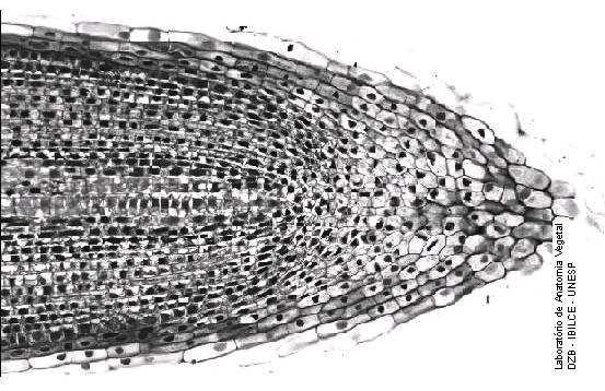QUESTÃO 6 06 - A figura abaixo representa a ponta de uma raiz de alho, vista ao microscópio de luz. As linhas tracejadas A e B representam duas posições onde poderia ser cortada a raiz.