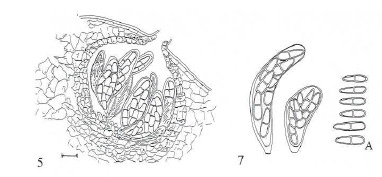 Mancha de micosferela: Mycosphaerella e Teratosphaeria Fungi --- Ascomycota ------