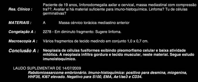 Rabdomiossarcoma do mediastino anterior um tumor comum em localização rara A propósito de um caso Os sintomas mais comuns nas massas mediastinais são tosse (60%), dor torácica (30%), febre (20%) e